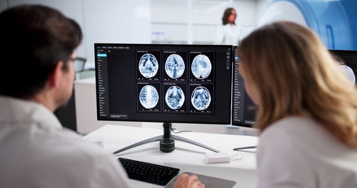 two radiologists reviewing brain MRI scans on computer monitor in medical facility